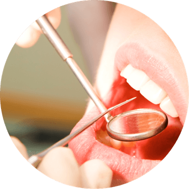 치위생사 구강관리